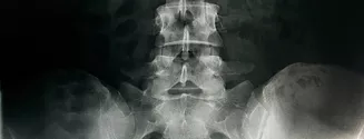 Radiographie pelvienne